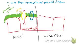 Cystic fibrosis