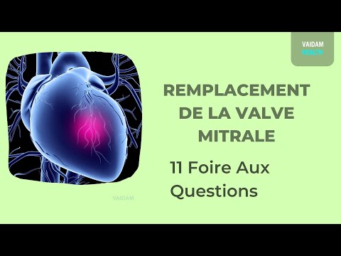 REMPLACEMENT DE LA VALVE MITRALE