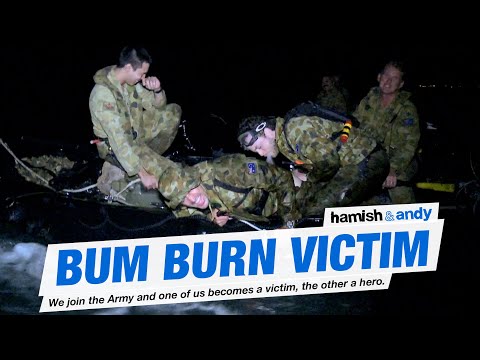 Bum Burn Victim | Hamish & Andy