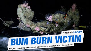 Bum Burn Victim | Hamish & Andy