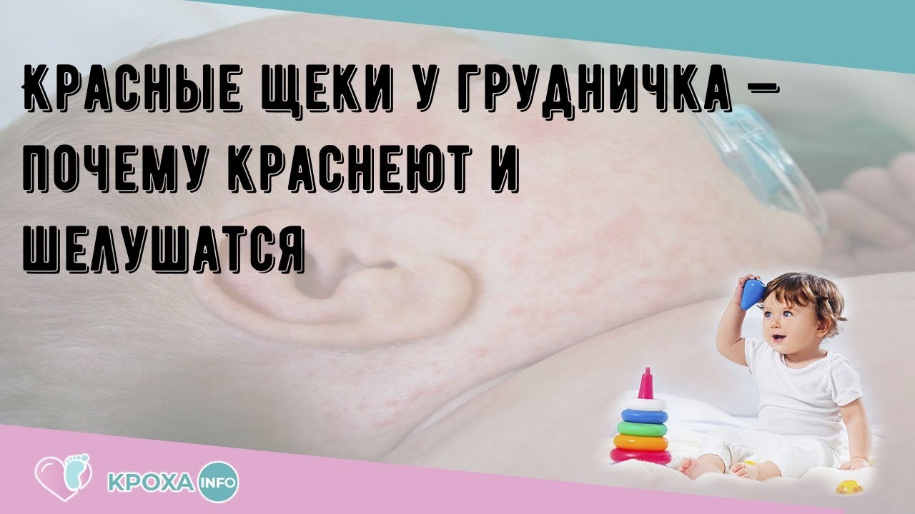 Красные щеки у грудничка — почему краснеют и шелушатся
