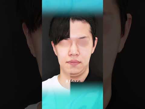 二重アゴが気になる……