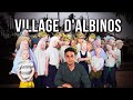 Une Visite au Village des albinos en Afrique (Ils se font Tuer parce qu'ils sont Blancs)