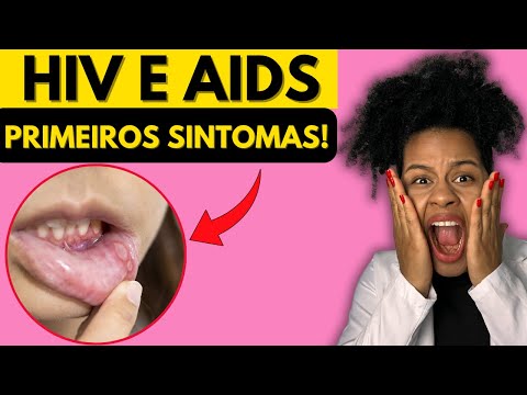 HIV e AIDS - QUAIS SÃO OS PRINCIPAIS SINTOMAS? COMO SABER SE TENHO AIDS?