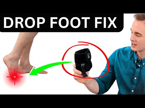 STOP Foot Drop: Easy Solution.