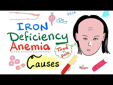 Iron Deficiency Anemia (Causes)
