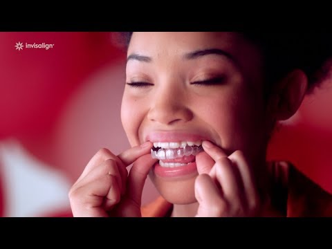 Class II Malocclusion Invisalign® | ALFIE Dentistry
