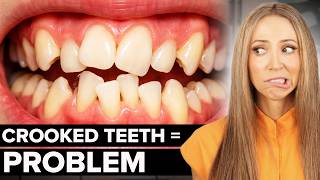 Hygienist Explains Why YOU Should Get Braces