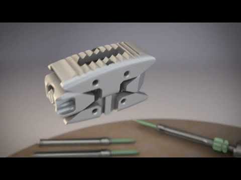 DepuySynthes: unleash MIS TLIF; VIPER PRIME, CONCORDE LIFT