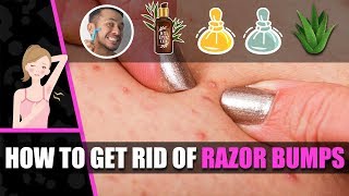 Razor bumps - How to get rid of razor bumps - Get rid of razor burns