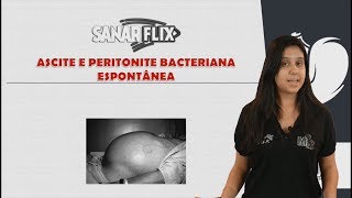 Ascite e Peritonite Bacteriana Espontânea (PBE) - Aula completa - SanarFlix