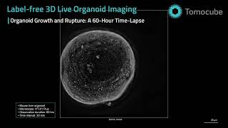 Mouse Liver Organoid Time Lapse - HT-X1 Plus Label-Free 3D Imaging
