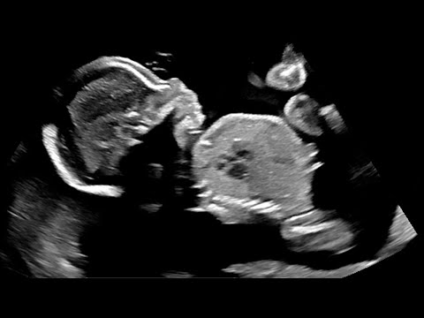 This changes everything.