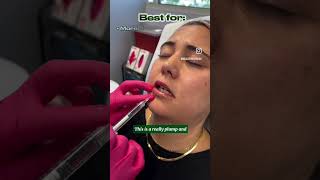 Do you have very thin lips?😮