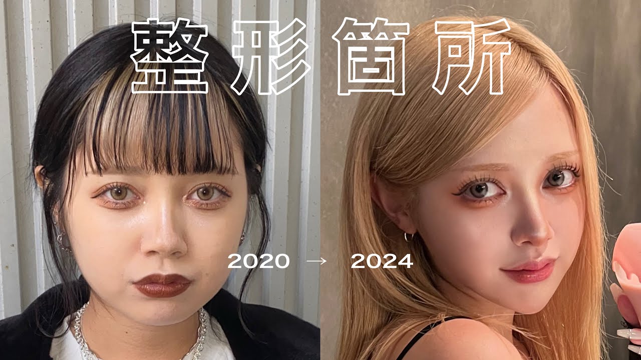 総額250万の整形履歴書