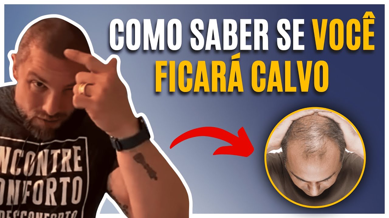 CALVÍCIE | Muzy Explica