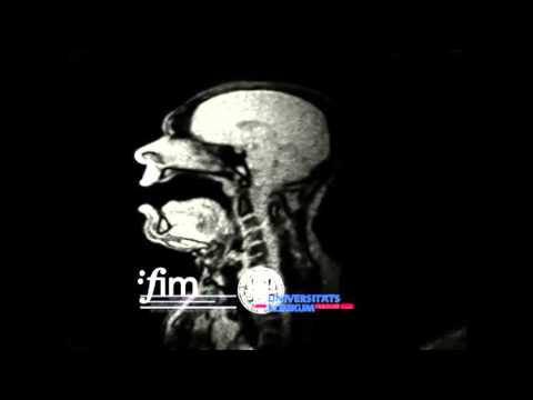 Morphometric Differences of Vocal Tract Articulators in Different Loudness Conditions in Singing