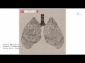 Relient K | Collapsible Lung_Can't Complain.mp4