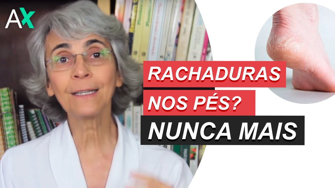 Rachaduras nos pés? Nunca mais