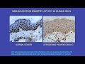 CARTA Unique Features Of Human Skin Ultraviolet Radiation Effects On DNA And Carcinogenesis