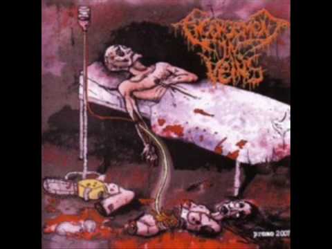 Engorgement In Veins - Night Of Autopsy