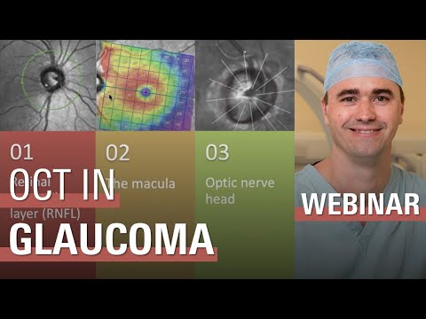 OCT in the Diagnosis and Management of Glaucoma