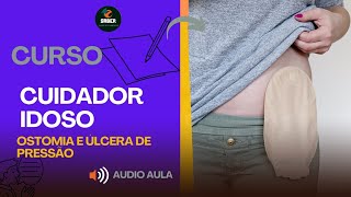 OSTOMIA E ÚLCERA DE PRESSÃO