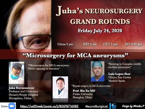 Stenting in Complex Middle Cerebral Aneurysms