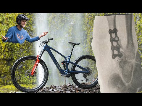 New Bike! Trek Fuel EXe -- And How I Broke My Hand.