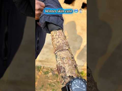 Winter Skincare | 🤒