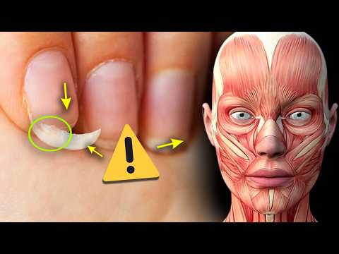 5 ALARMING Signs Your Weak Nails Are Trying To Tell You SOMETHING