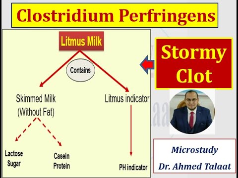 Clostridium Perfringenes (Morpholohy,Culture & Biochemical reactions)" Medical microbiology