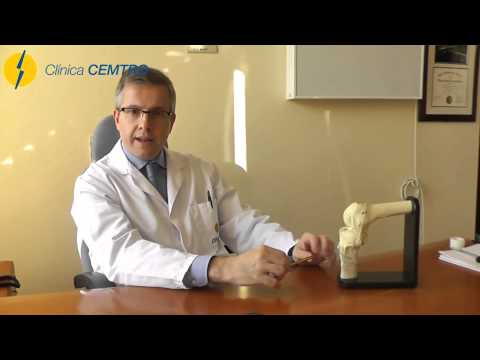 Fractura de la meseta tibial