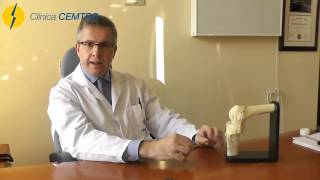 Fractura de la meseta tibial