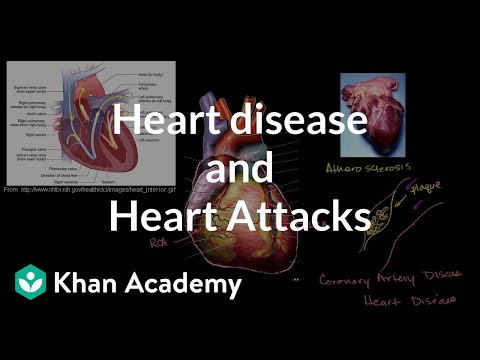 A thumbnail for: Heart Disease and Stroke