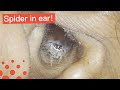 SPIDER CRAWLS OUT OF WOMAN 039 S EAR von New