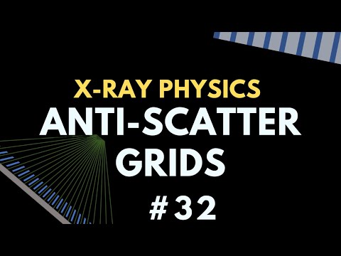 Anti-scatter grids | X-ray Physics | Radiology Physics Course #39