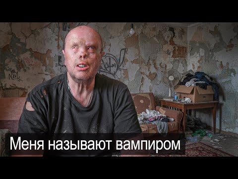 I WANT TO LIVE LIKE ALL NORMAL PEOPLE.