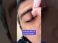A Simple Way To Use Eye Drops!