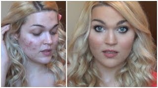 Everyday Acne Coverage Foundation Routine + Contouring For Flawless Skin