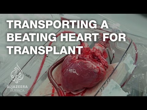 image-How much does it cost to wear a heart monitor for 30 days?
