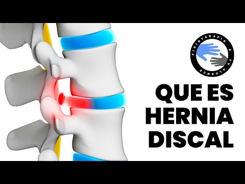 Di articolazioni cura delle gambe e fianchi a casa spettacolo Congelamento spruzzo per le articolazioni