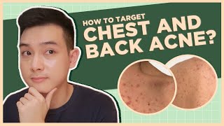 Get rid of CHEST & BACK ACNE: BEST PRODUCTS + DOs and DON