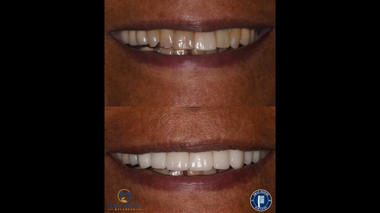 Smile Gallery Video 6