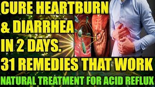 HOW TO GET RID OF HEARTBURN FAST (ACID REFLUX CURE) -  HOME REMEDIES FOR LOOSE MOTION, DIARRHEA