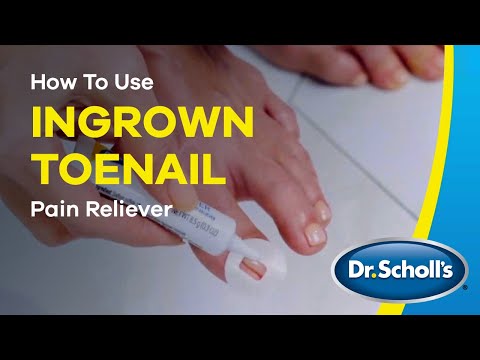 Dr. Scholl's | How To Use Ingrown Toenail Pain Reliever