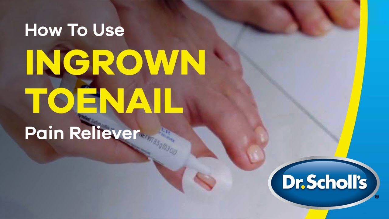 Ingrown Toenail Treatment & Pain Relief Dr. Scholl's®