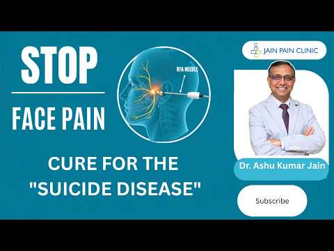 Watch video on trigeminal neuralgia treatment