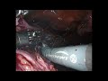 video thumbnail (15)