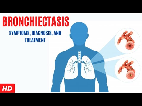 Bronchiectasis: Symptoms, Diagnosis and Treatment